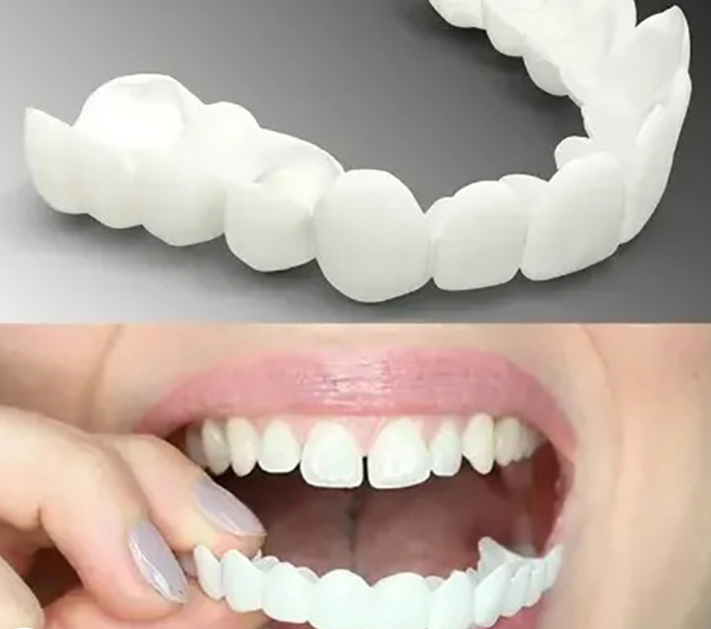 Comfortable, adjustable snap-on temporary dentures for an instant beautiful smile. Simple to fit over existing teeth.