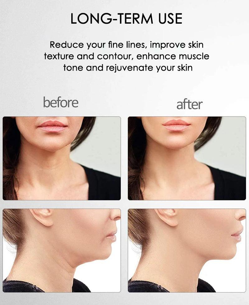 Facial massager with microcurrent technology for firming face, chin, jawline, and neck.