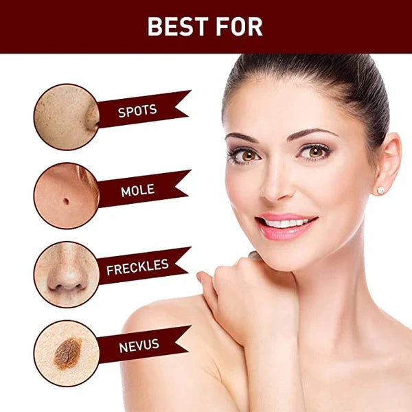 Smiling woman with clear, blemish-free skin after using natural skin tag & mole remover. Boost confidence.