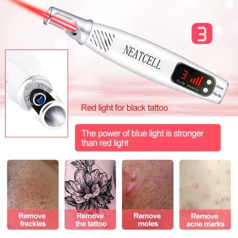 Versatile laser pen for home skin correction, tattoo, mole, freckle & dark spot pigment reduction.