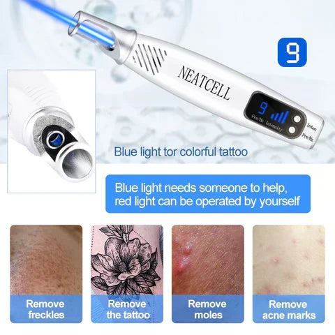 Effective home beauty laser pen for skin correction, tattoo & spot removal.