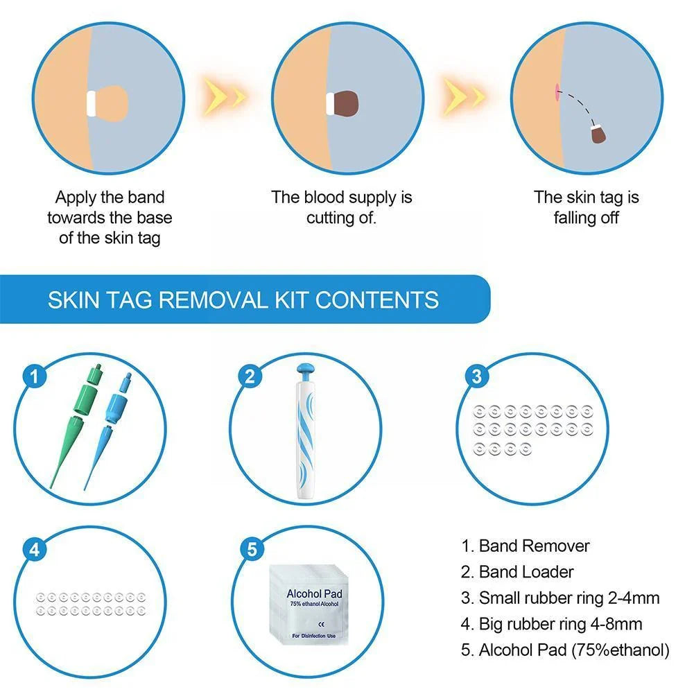 User applying the Painless Auto Skin Tag Remover Kit for quick, gentle blemish removal and clear skin.