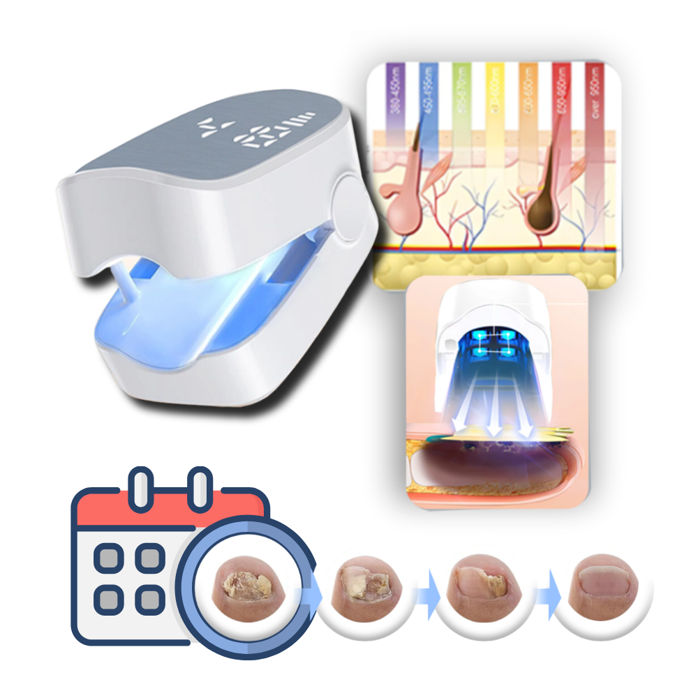 Advanced laser therapy device treating toenail & fingernail fungus for clear, healthy, pain-free nails. Home care.