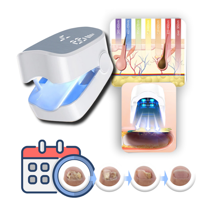 Advanced laser therapy device treating toenail & fingernail fungus for clear, healthy, pain-free nails. Home care.