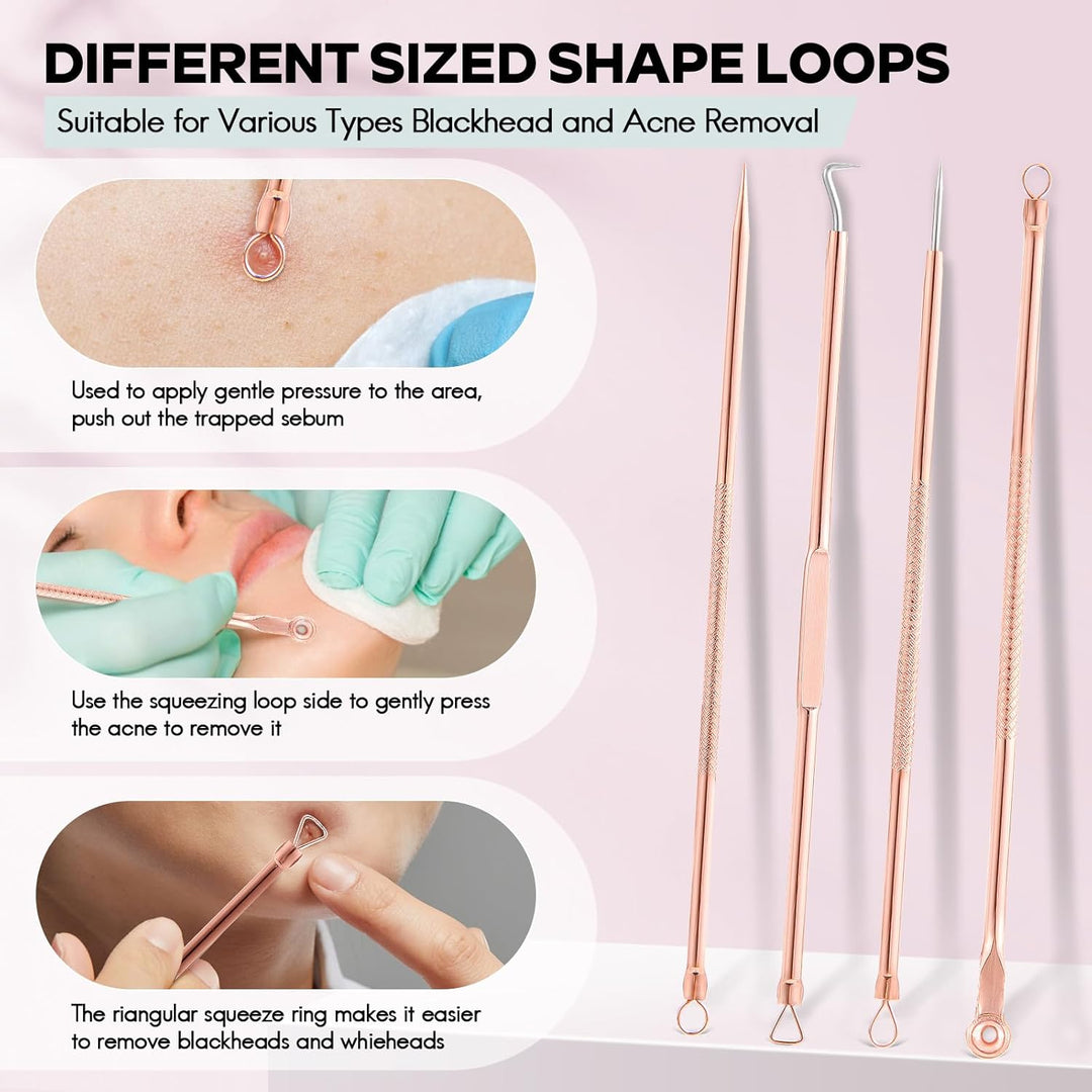 Close-up of a professional blackhead remover kit highlighting different sized loops and lancets for blemish removal