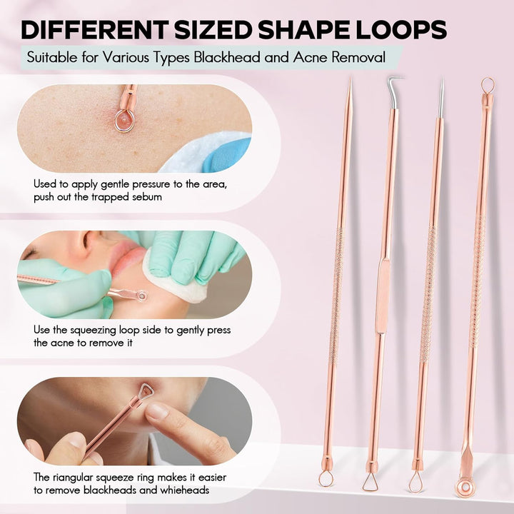 Close-up of a professional blackhead remover kit highlighting different sized loops and lancets for blemish removal