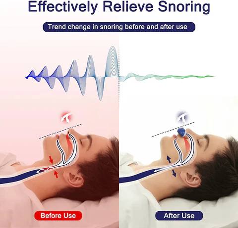 Maskless nasal CPAP device for sleep apnea & snoring. Promotes wellness with comfortable breathing & quality sleep.