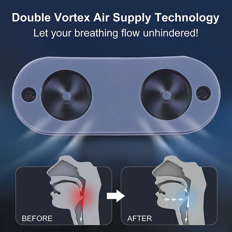 Compact Sandsberg032518 maskless nasal CPAP device. Snoring & sleep apnea relief for comfortable, uninterrupted sleep.