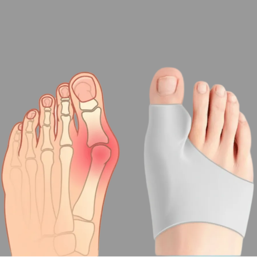 Beige bunion corrector designed for youth comfort, promoting foot health & mobility for daily wear.