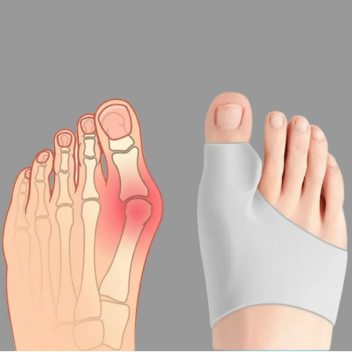 Beige bunion corrector designed for youth comfort, promoting foot health & mobility for daily wear.