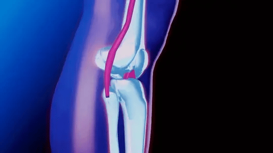 Compression knee support with adjustable straps for pain, arthritis, injury recovery & sports stability.