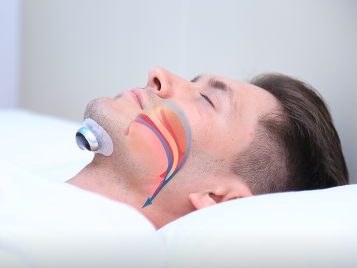 Health and wellness anti-snoring gadget for deep, undisturbed sleep; a smart snore stopper.