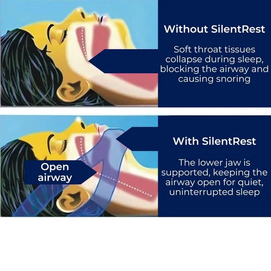 Adjustable full head chin strap for snoring. Comfortable night use sleep aid for sleep apnea and mouth breathing.