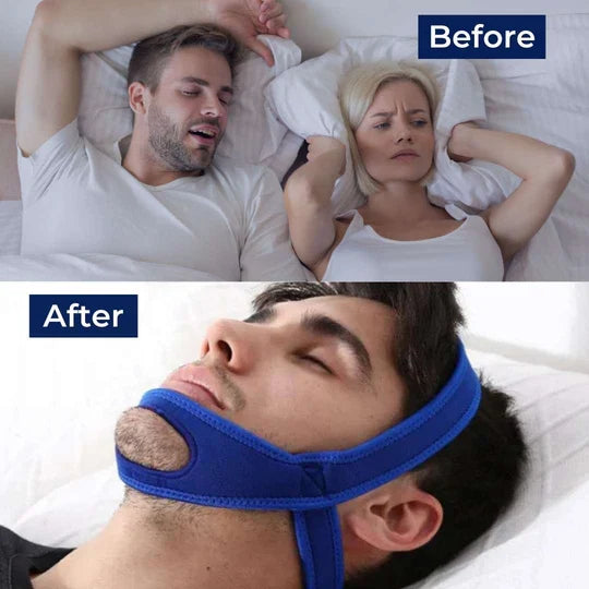 Comfortable unisex chin strap for snoring & sleep apnea relief. Anti-snoring sleep aid for night mouth breathing.