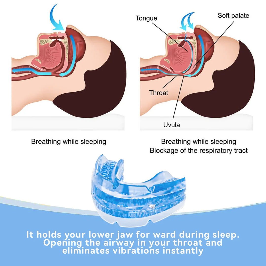 Close-up of a customizable night guard, an anti-snore sleep aid that gently supports jaws for quiet, restful sleep.