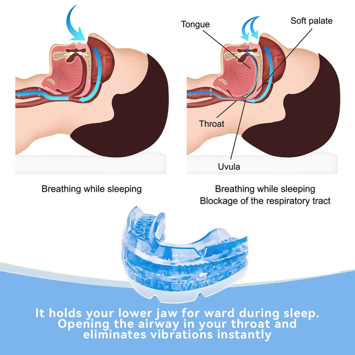 Close-up of a customizable night guard, an anti-snore sleep aid that gently supports jaws for quiet, restful sleep.