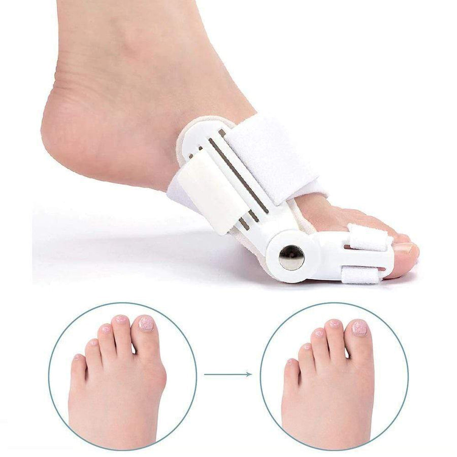 Adjustable bunion corrector splint pair for hallux valgus, providing orthopedic support & pain relief.