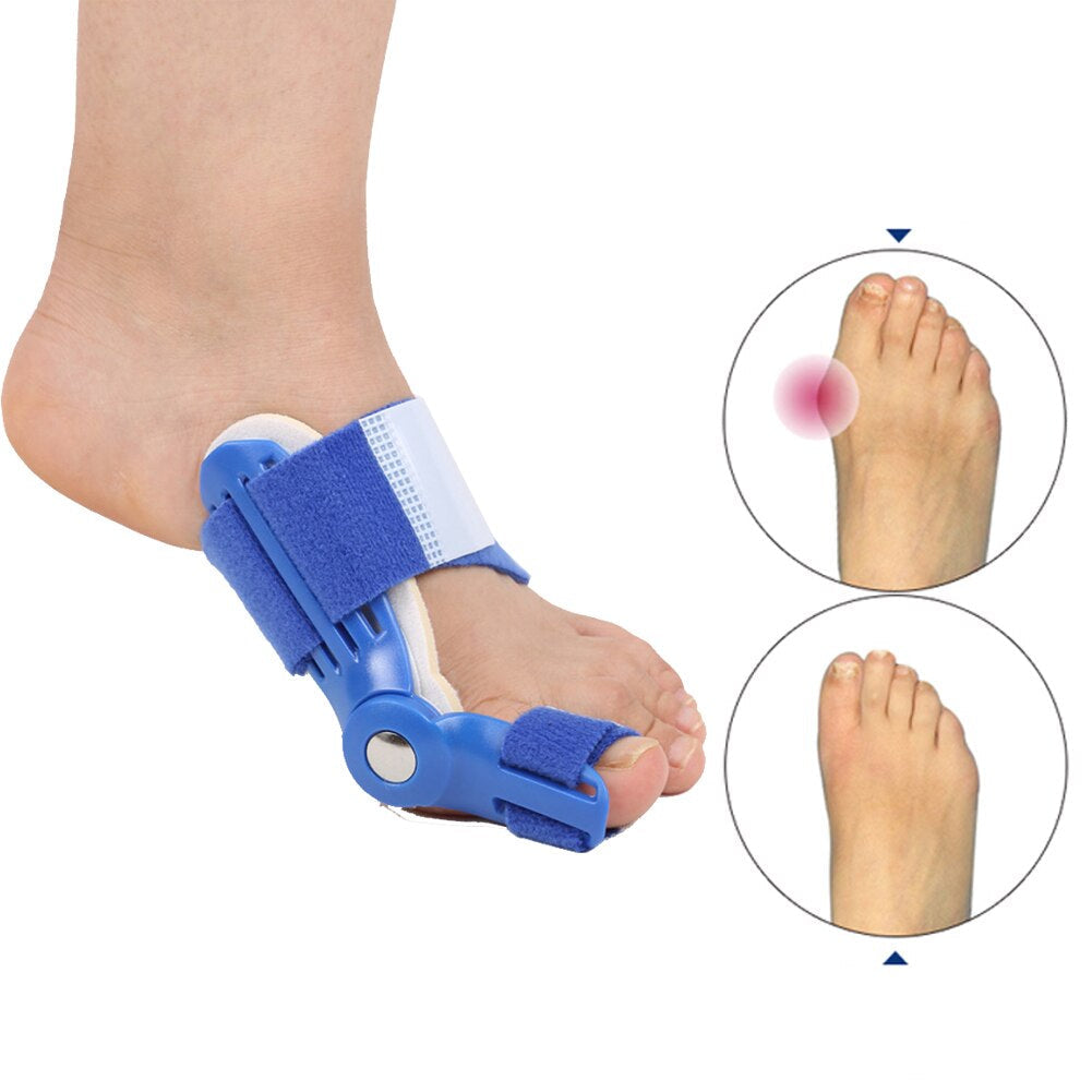 Foot pain relief splint: adjustable bunion corrector for hallux valgus, suitable for daily wear.