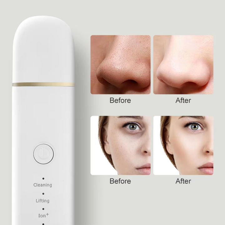 Multiple angles of the rechargeable Ultrasonic Skin Scrubber, a versatile skincare beauty tool.