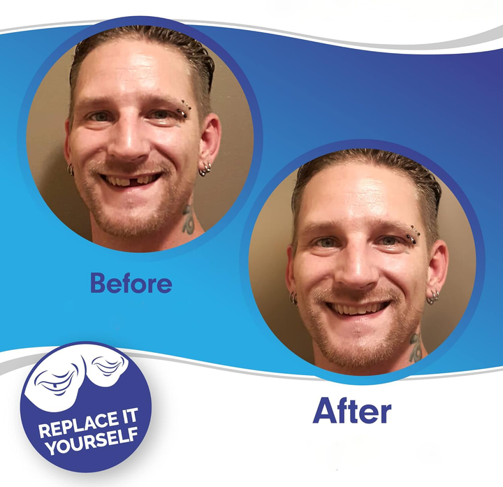 Achieve a confident perfect smile with this instant veneer kit. Clip-on cosmetic teeth for upper and lower.
