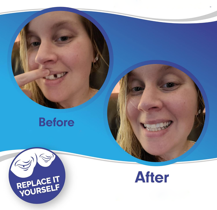 Temporary dental covers for a quick teeth makeover. Unisex instant smile solution for upper and lower teeth.