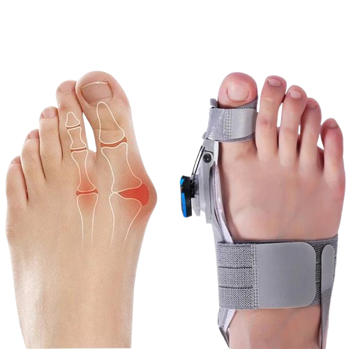 Unisex natural bunion corrector toe spacer for effective pain relief & toe realignment.