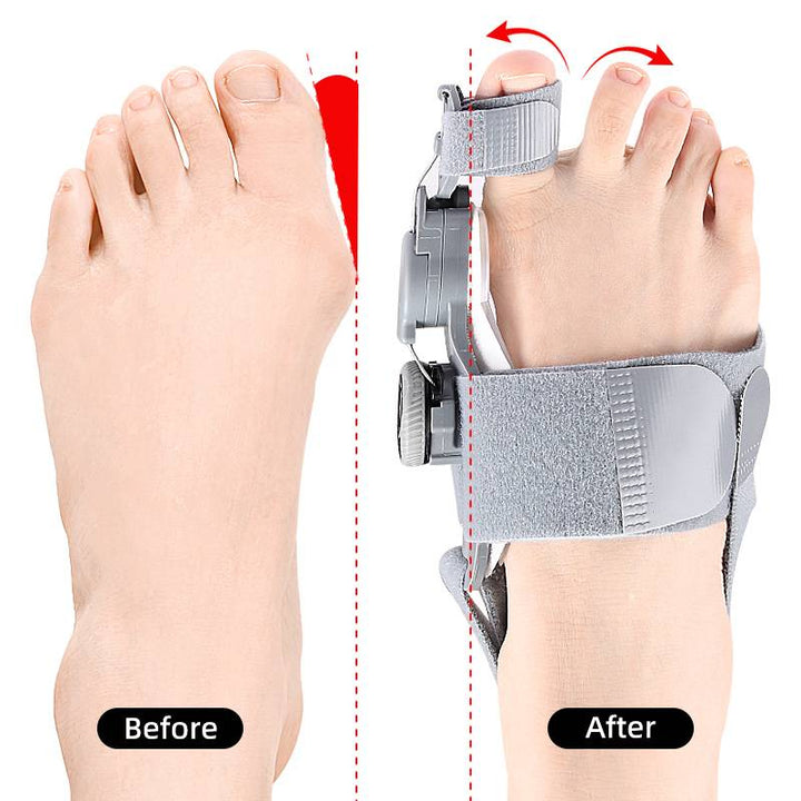 Adjustable bunion splint & toe spacer provides targeted foot pain relief & support.