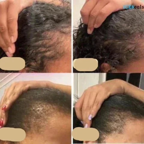Bottle of Natural Hair Growth Oil. Strengthens roots, promotes fuller, shinier hair. Organic scalp treatment.