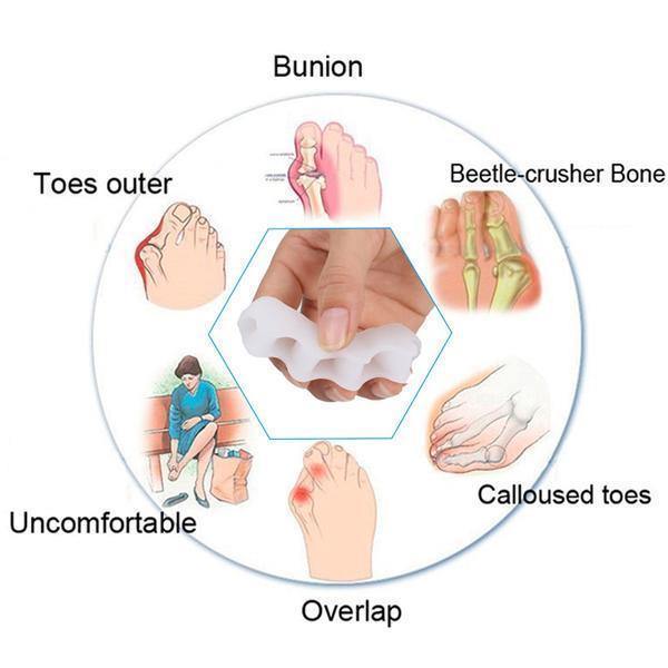 Adjustable orthopedic toe splint & separator for bunion and hammer toe relief, promoting foot alignment.