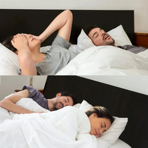 Compact micro CPAP alternative for sleep apnea. Comfortable, hoseless anti-snoring breathing device.