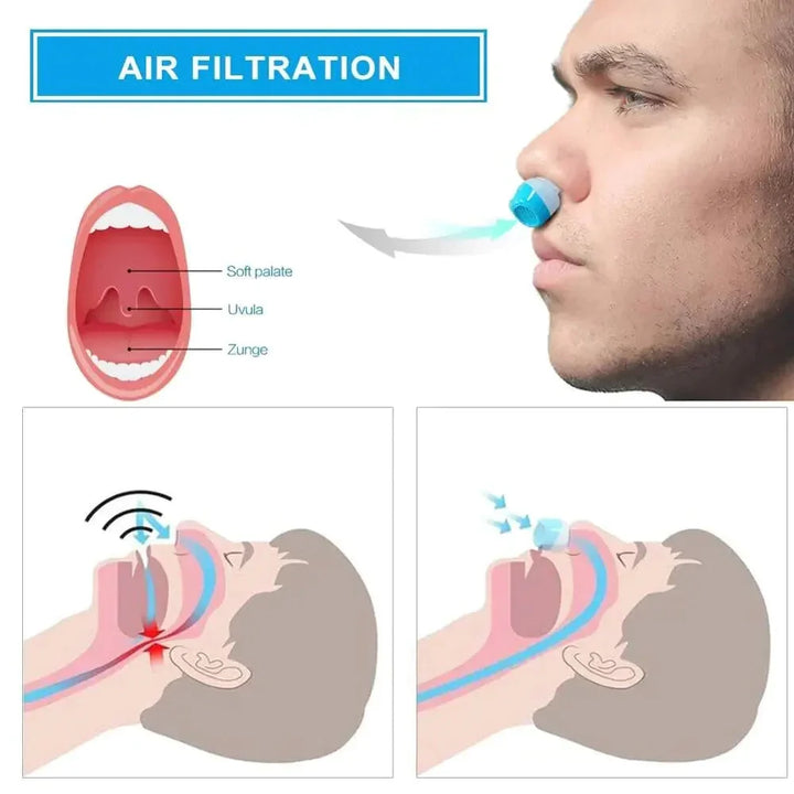 Effective micro CPAP sleep solution. Portable anti-snoring breathing device for sleep apnea relief.
