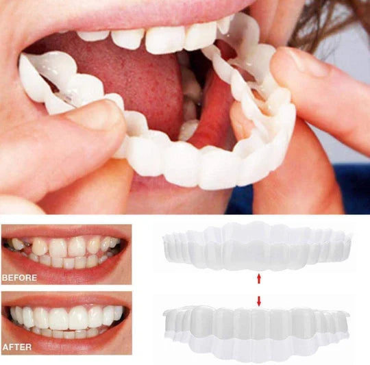 Easy-to-use unisex temporary clip-on veneers for quick, instant smile enhancement. Reusable cosmetic dental solution.