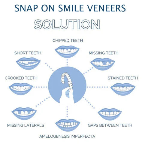 Achieve a perfect temporary smile with these unisex clip-on veneers for instant dental aesthetic enhancement.