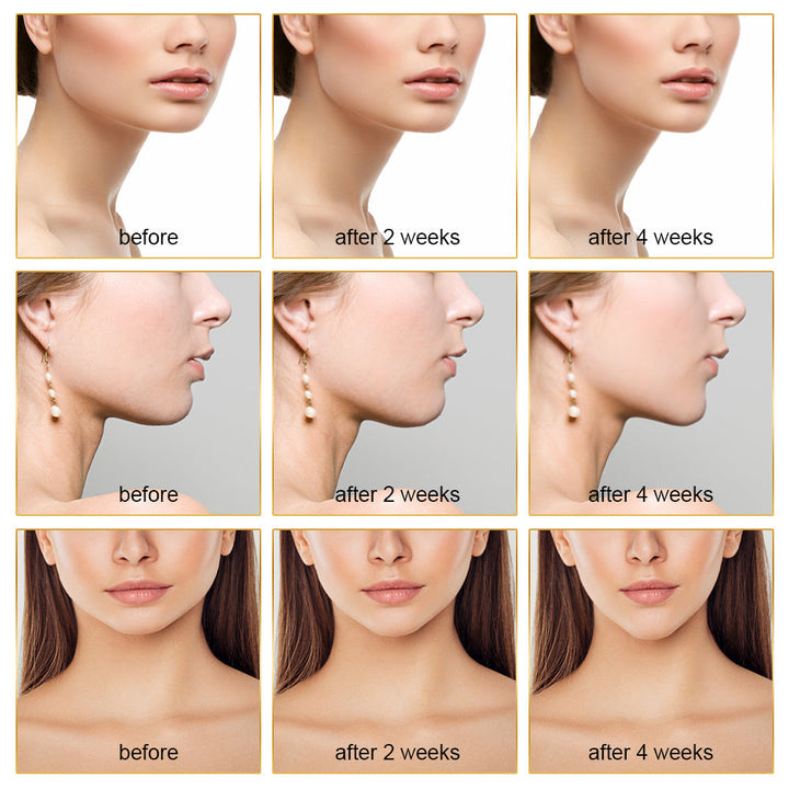 Woman applying EMS facial sculptor with LED light to target cheekbones for a lifted look